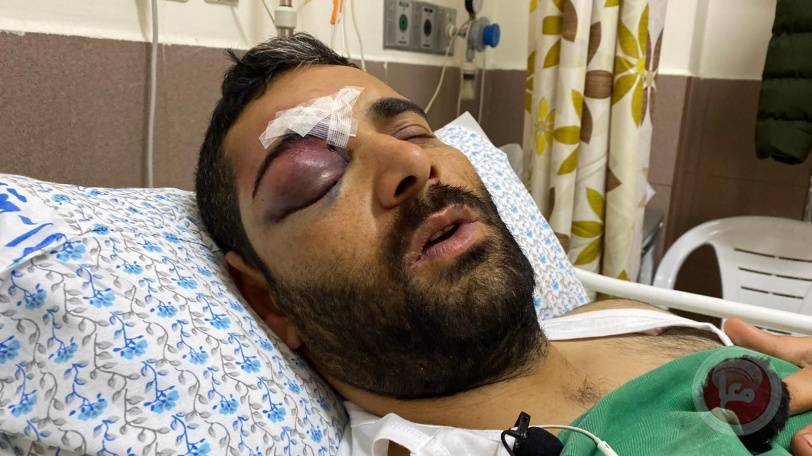 Al-Aqsa employees are targeted - skull fractures, limb fractures and bruises