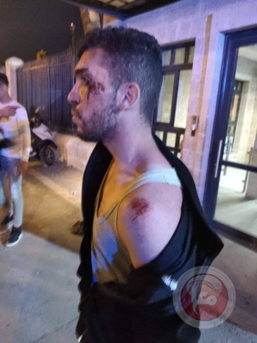 Dozens of injured during confrontations with the occupation in Beita and Beit Furik