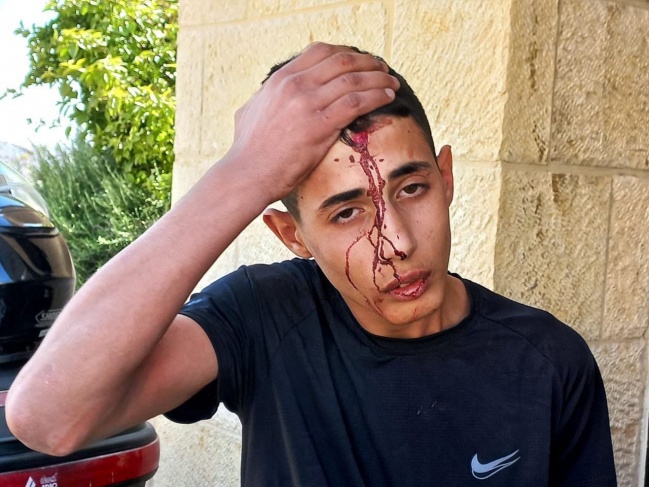 Clashes in Silwan... Settlers attack a child in Jerusalem