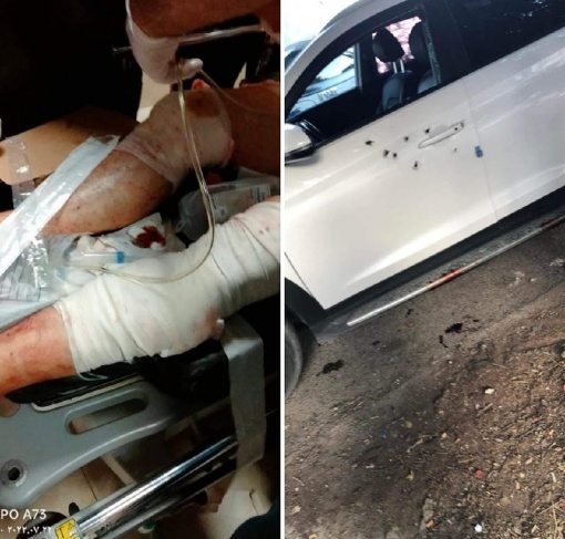 مسلحون يطلقون النار على د.ناصر الدين الشاعر واصابته بجراح جنوب نابلس(فيديو)