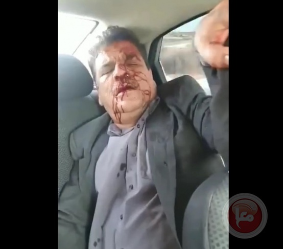 A settler ran over a Fatah leader, Bayan al-Tabiq, in Qalqilya (video)