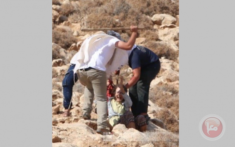 Settlers stab solidarity and attack another, east of Bethlehem