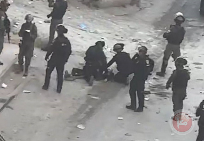 Witness - seriously injured by the occupation bullets in Shuafat camp