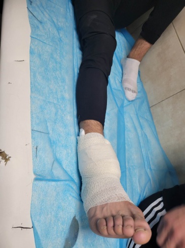 A child was wounded by the occupation bullets in Aida camp
