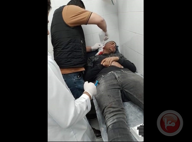 Salfit: A young man was injured by settlers' stones